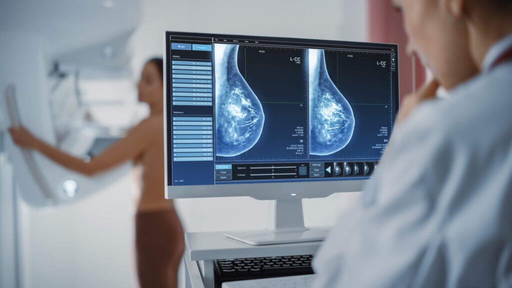 Woman doctor analyzing mammography image on a computer screen while patient undergoes a mammogram in background.